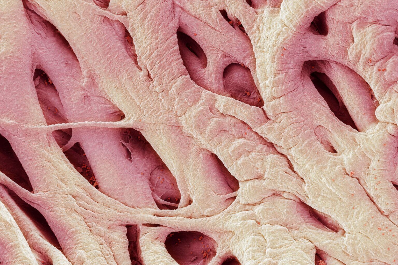 smallest pacemaker-cardiac innovation-bioresorbable-medical technology-John A. Rogers