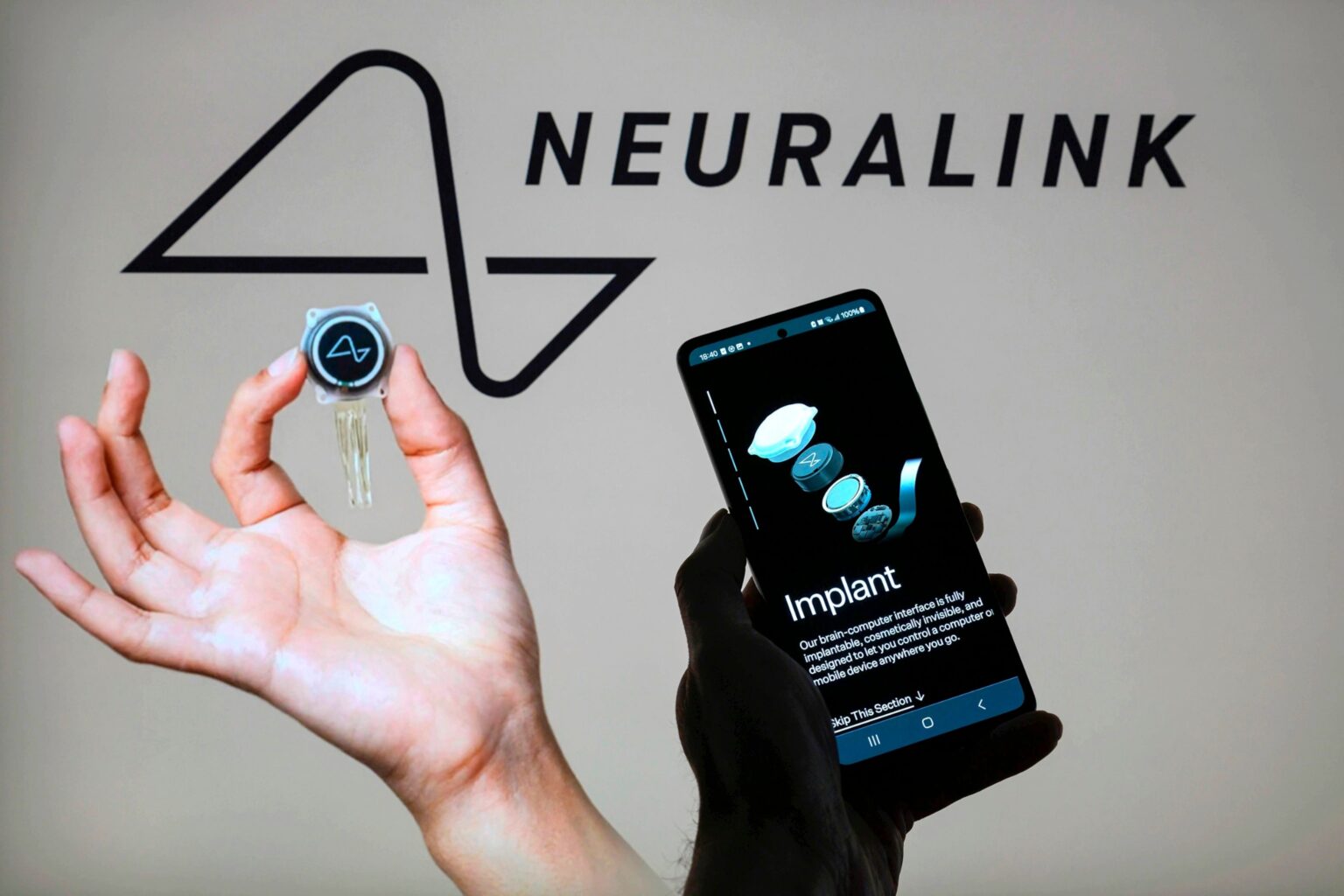 Neuralink-Elon Musk-brain chips-UAE-medical technology-neural implants