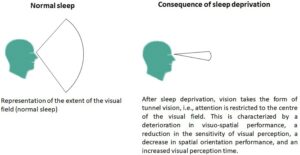 excess sleep-cognitive decline-brain health-depression-neurology research-sleep psychology