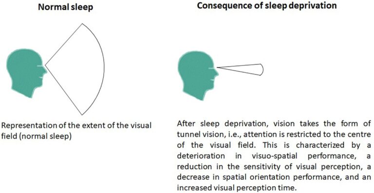 excess sleep-cognitive decline-brain health-depression-neurology research-sleep psychology