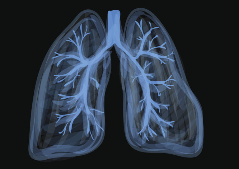 vape-popcorn lung-chemical inhalation-vape risks-teens and vaping